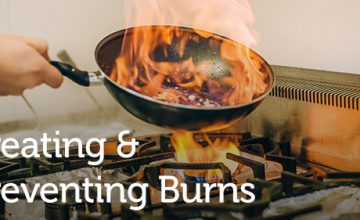 Treating & Preventing Burns