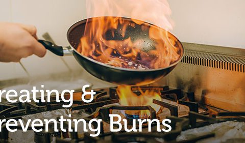Treating & Preventing Burns - Take Stock Magazine